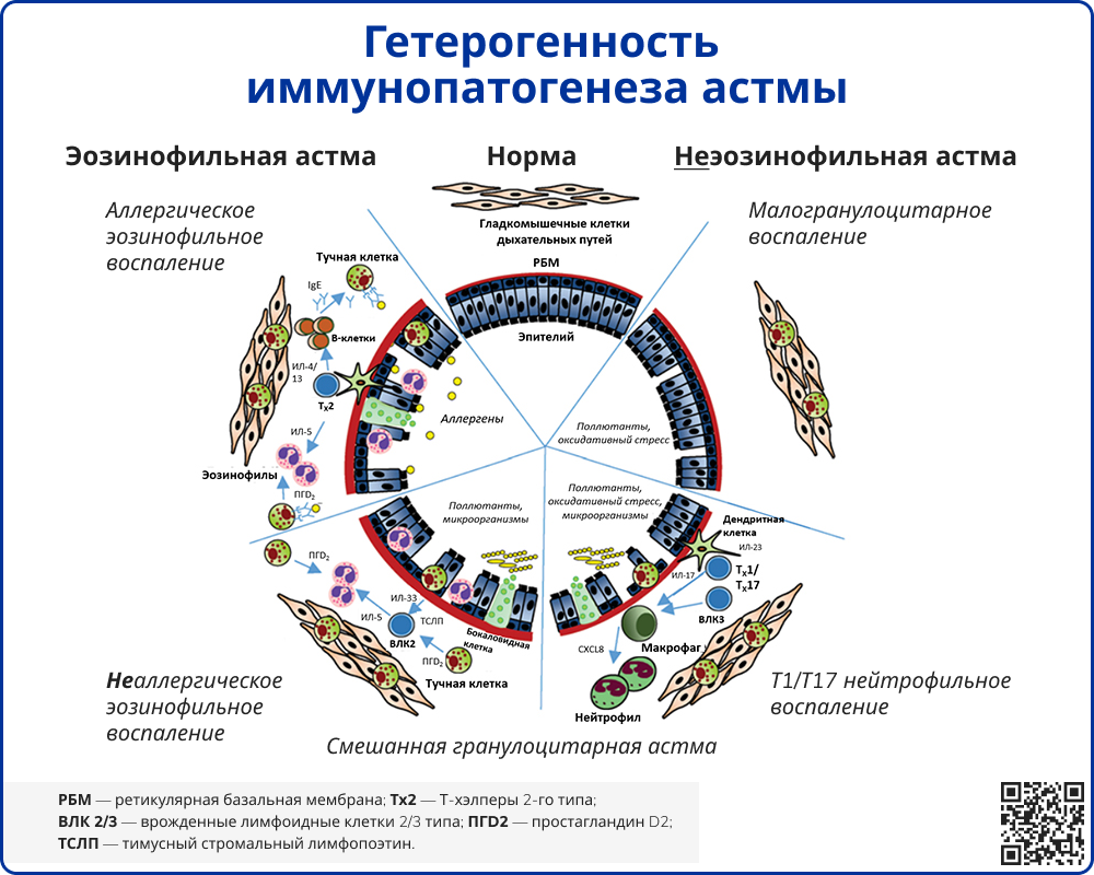 Гетерогенность иммунопатогенеза астмы